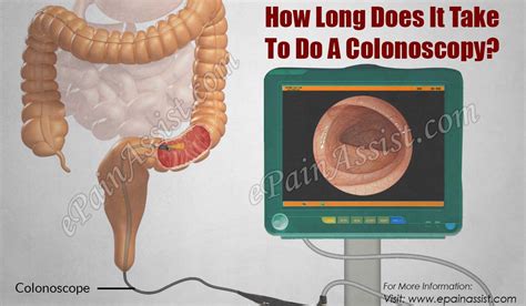 where does a colonoscopy check